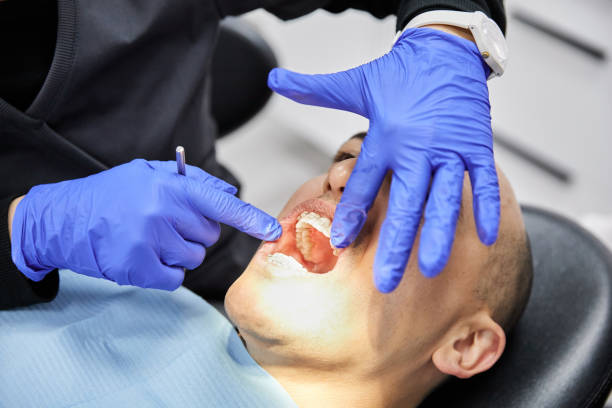 Best Emergency Tooth Extraction in Mason City, IL